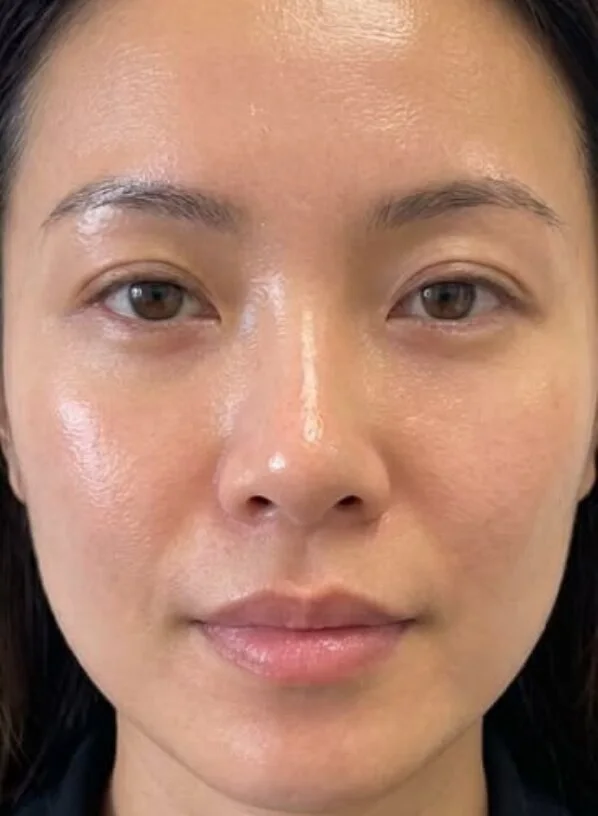 After: same guest with a brighter skin appearance