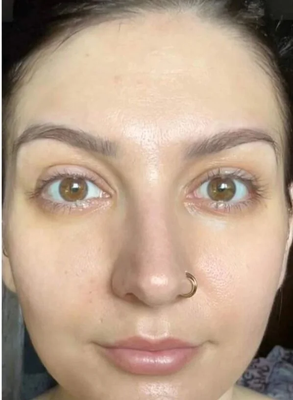 After photo: dullness & glow